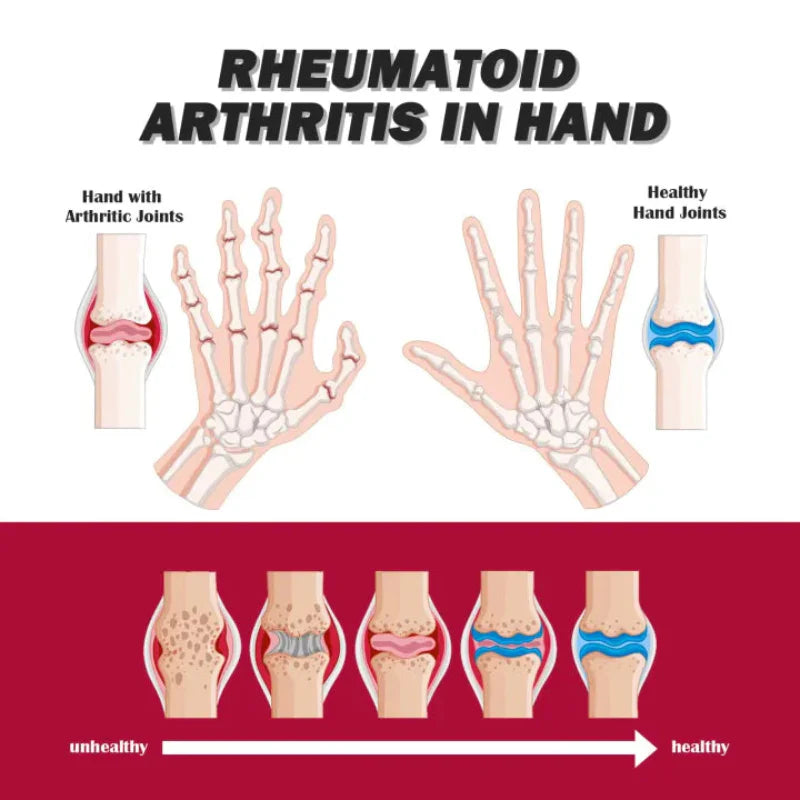 🦴✨ South Moon Intensive Concentrate Cream – Joint & Bone Therapy 🦴✨ ( BUY 1 GET 1 FREE )