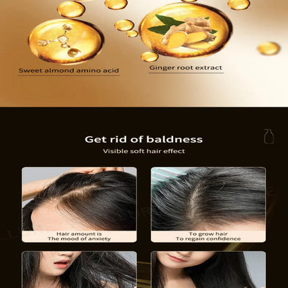IUALLURE™ Ginger Development Shampoo ( BUY 1 GET 1 FREE )