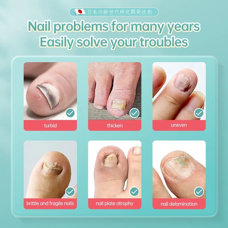 Dr.ville Nail Fungus Treatment Spray