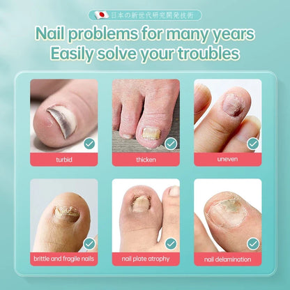 Dr.ville Nail Fungus Treatment Spray