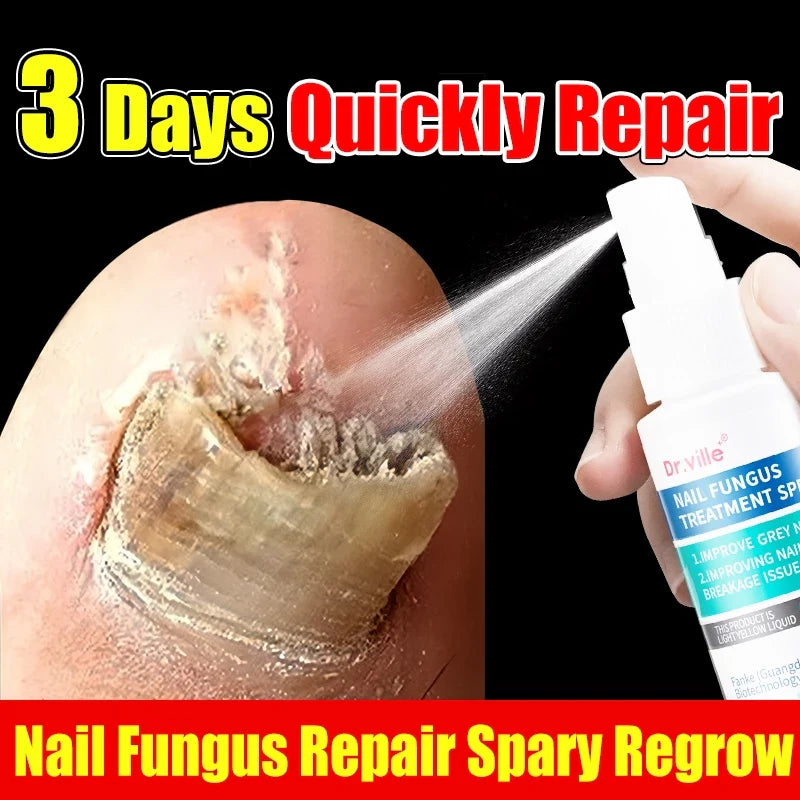 Dr.ville Nail Fungus Treatment Spray