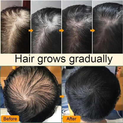 LiQT Anti–Hair Growth Ginger Shampoo ( BUY 1 GET 1 FREE )