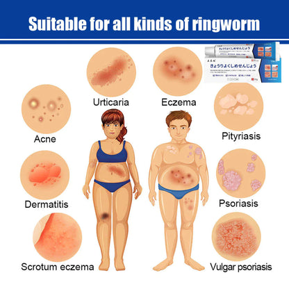 Japan Anti - Fungal Ointment Eczema Cream ( BUY 1 GET 1 FREE )