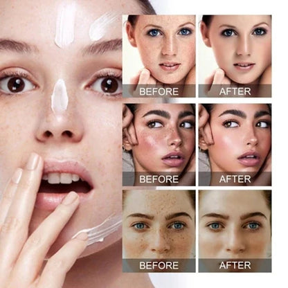 🌺🌙 GlowFade Radiance Repair Cream – Freckle, Pigmentation & Acne Scar Solution 🌸💧